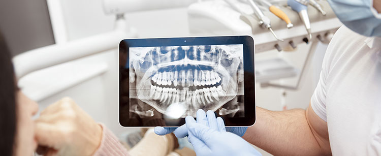 Table with xray of teeth is being shown to the patient